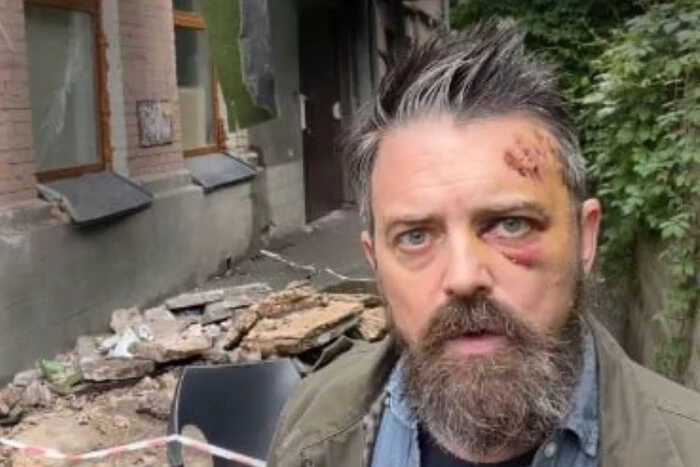 An American Fell with a Balcony in Kyiv (video)